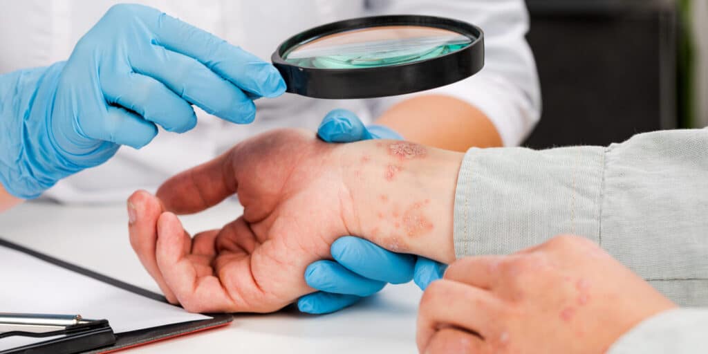 Autoimmune diseases explained at Chirolink Chiropractor Auckland