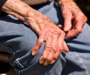 Osteoarthritis